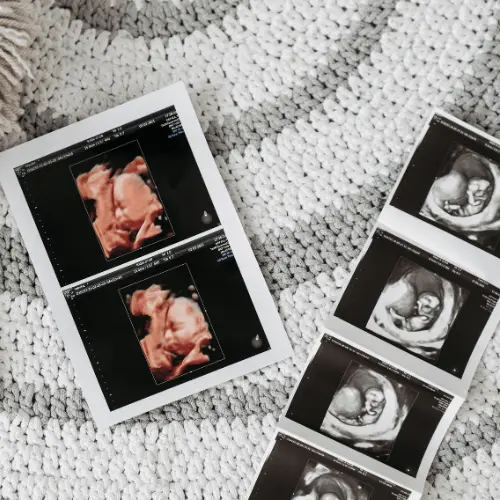 4d baby scan clinic in slough